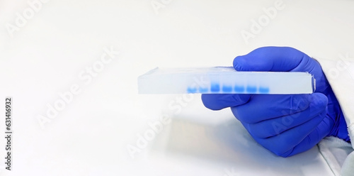 Photos Scientist's hand showing an Agarose gel with DNA or protein samples, used in a l