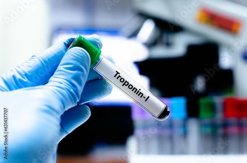 Blood sampling tube for troponin I analysis. photo