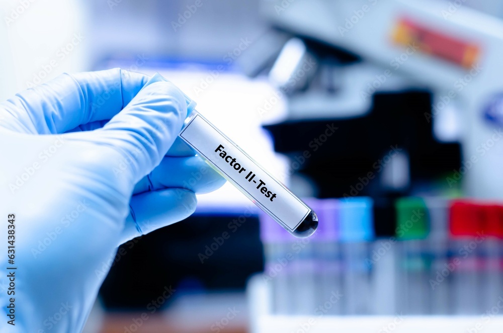 Blood sampling tube for factor ii analysis. Blood sampling tube for factor ii analysis.