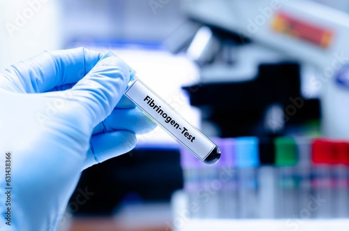 Blood sampling tube for fibrinogen analysis. photo