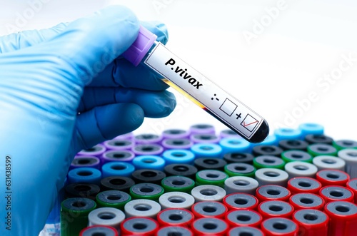 Blood sample of malaria patient positive test for plasmodium vivax. photo