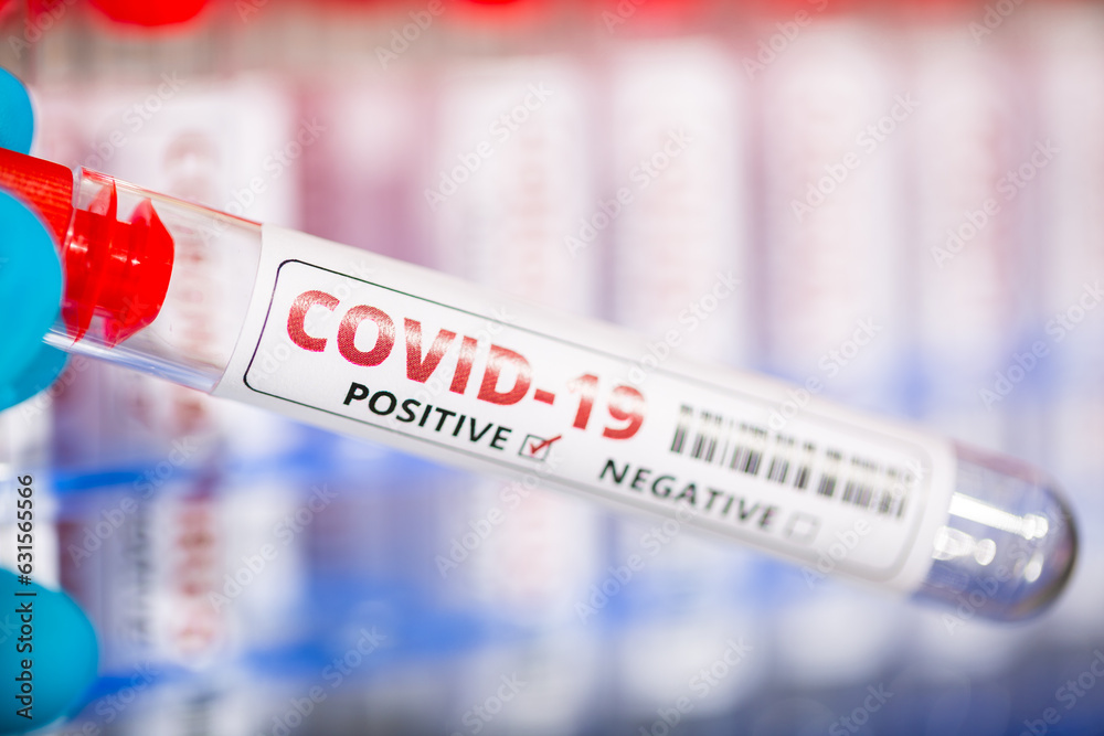 Fototapeta premium Test tube with blood for 2019 Covid 19 analyzing