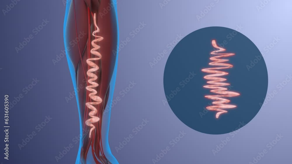 Human legs with varicose veins concept of health and disease