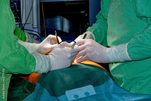 Preparing the patient for endoscopic surgery. Medical team of surgeons in the hospital who perform minimally invasive surgical procedures. photo