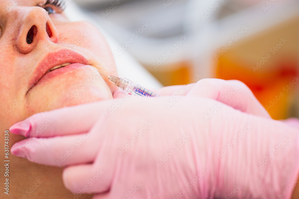Φωτογραφία Subcutaneous injections of fillers with a syringe in a medical salon - aesthetic