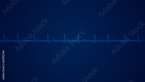 Heart beat pulse electrocardiogram rhythm on blue background