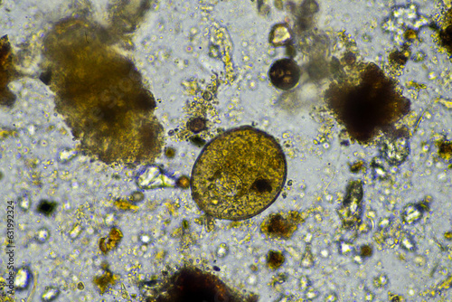 arcella testate amoebae under the microscope from a soil sample on a farm. a living soil photo