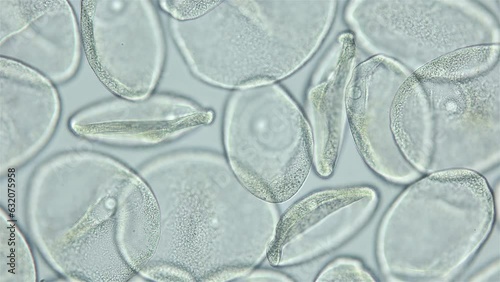 Sperm and ovule of worm Polychaeta Ophelia limacina under microscope, Opheliidae family. You can see movement of spermatozoa, that attach to egg for fertilization. White sea