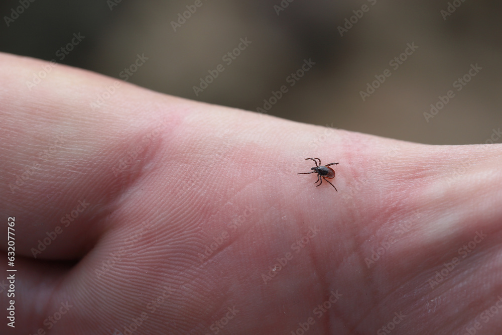 A tick walking on the hand. It is a dangerous arachnid that is a vector of many pathogens, diseases.
