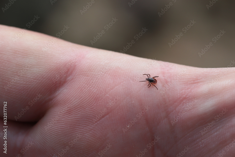 Obraz premium A tick walking on the hand. It is a dangerous arachnid that is a vector of many pathogens, diseases.