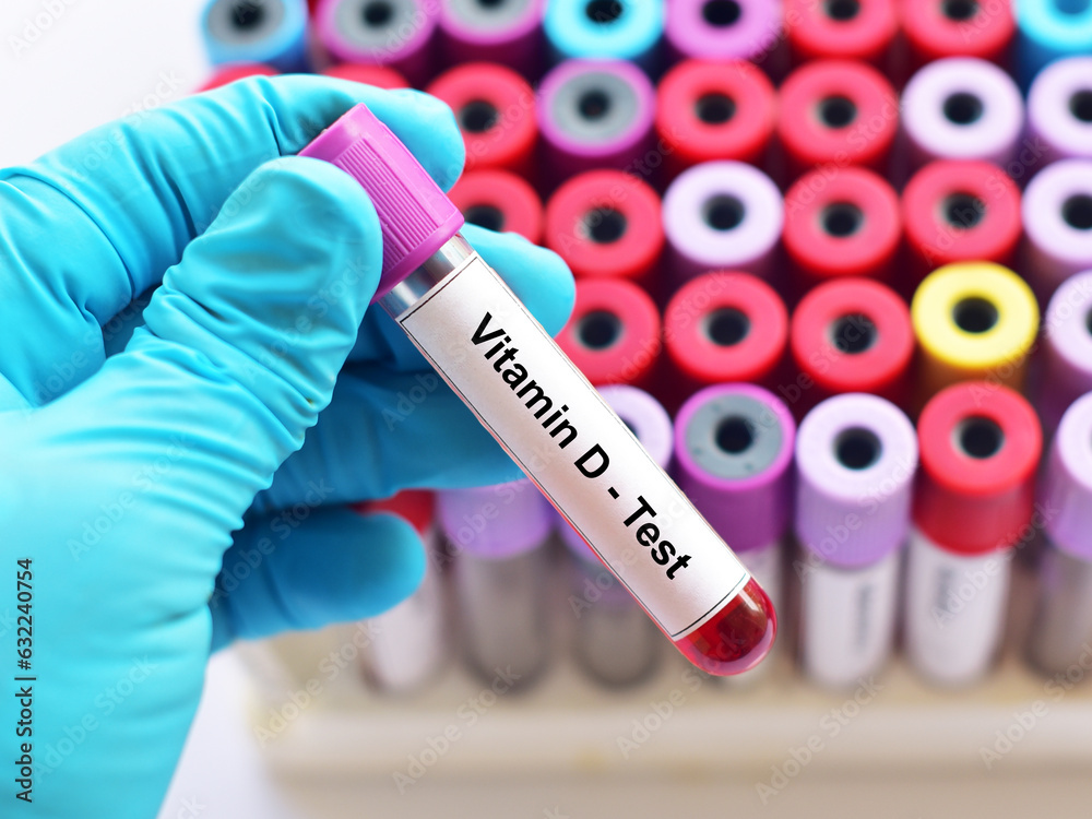 Obraz premium Blood sample tube for vitamin D test
