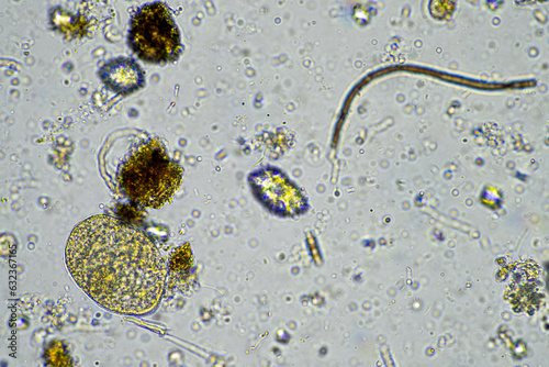 fungal hyphae on a soil sample on a farm. fungi storing carbon in the soil photo