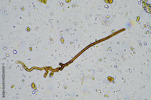 fungal hyphae on a soil sample on a farm. fungi storing carbon in the soil photo