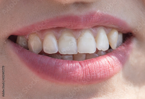 Lips and teeth of a smiling girl. Macro