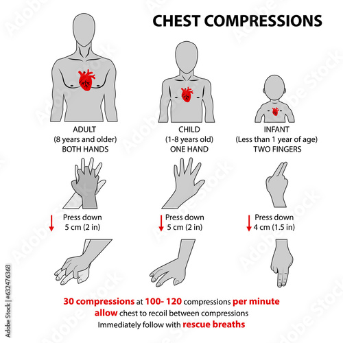 CPR chest compression photo