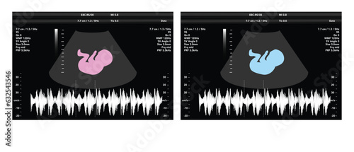 pregnancy ultrasound film genecology sonogram, medical ultra scan diagnostic control vector illustration graphic photo