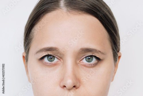 Foto Cropped shot of a young caucasian woman's face with drooping upper eyelids isola