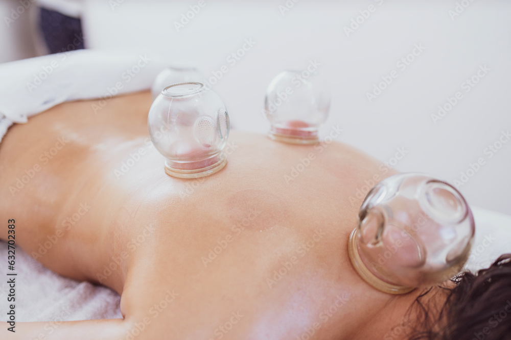 Hijama therapy with heated vacuum cups on patient skin to heal pain problems. Hijama therapy with heated vacuum cups on patient skin to heal pain problems.