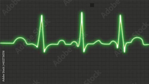 ECG paper with a normal sinus rhythm is a vector medical illustration. Recorded by an electrocardiogram is a neon human heart in normal sinus rhythm. Bright and striking style