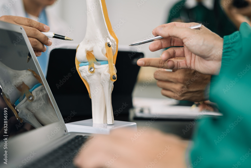 serious doctors team are analyzing fracture knee model showing the ...