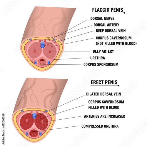 Flaccid penis, erect penis medical infographic in vector