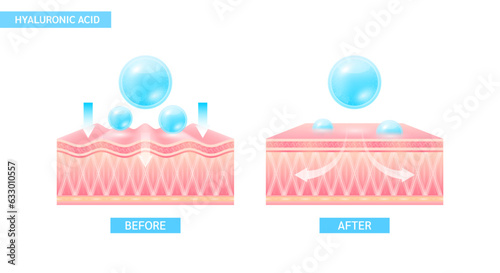 Hyaluronic acid serum drop blue absorbed into the skin cell. Before and after process of getting skin younger with help of moisturizer collagen. Solution for cosmetic advertising. 3D Vector EPS10. photo