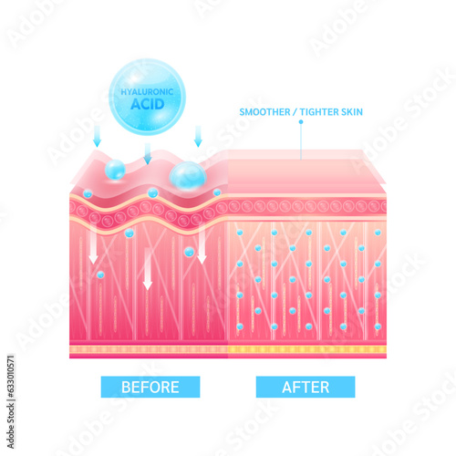 Hyaluronic acid serum drop blue absorbed into the skin cell. Before and after process of getting skin younger with help of moisturizer collagen. Solution for cosmetic advertising. 3D Vector EPS10.