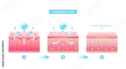 Hyaluronic acid serum drop blue absorbed into the skin cell. Before and after process of getting skin younger with help of moisturizer collagen. Solution for cosmetic advertising. 3D Vector EPS10.