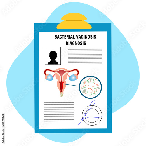 Bacteria vaginosis diagnosis medical illustration, gynecology 