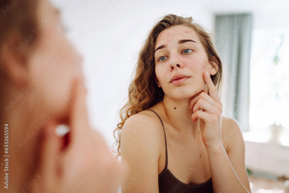 Close-up of a young woman looking at pimples in the mirror. Beautiful woman with acne problem skin checks dry face skin. Red spots, rash, acne. Skin treatment. Close-up of a young woman looking at pimples in the mirror. Beautiful woman with acne problem skin checks dry face skin. Red spots, rash, acne. Skin treatment.