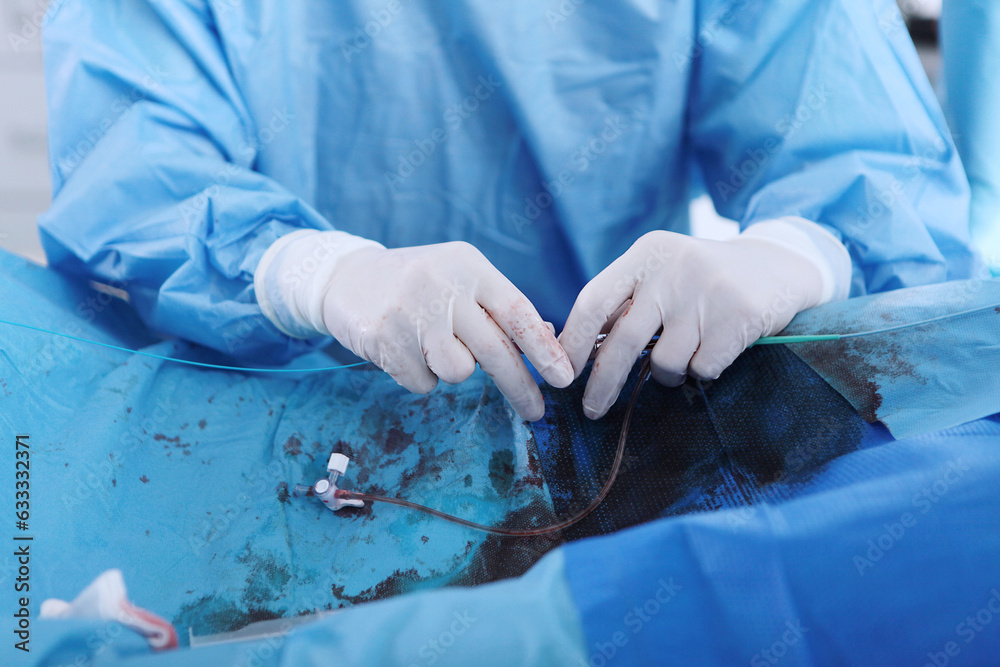 Surgery on blood vessels. Endovascular surgery. Surgical interventions