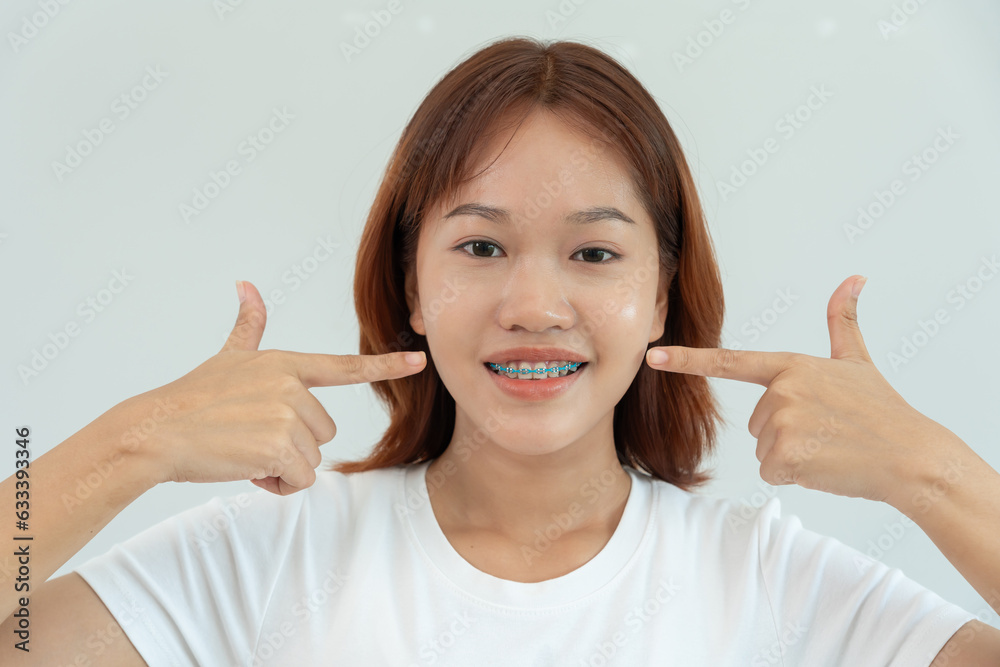 Treatment. Dental Care. Beautiful asian Woman Healthy Smile.Metal Brackets on Teeth. young Female Smile with Braces and show beautiful of teeth, Care after braces, confident in orthodontics Treatment. Dental Care. Beautiful asian Woman Healthy Smile.Metal Brackets on Teeth. young Female Smile with Braces and show beautiful of teeth, Care after braces, confident in orthodontics