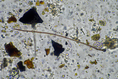 fungal hyphae and soil fungi in a soil sample, showing the living soil photo