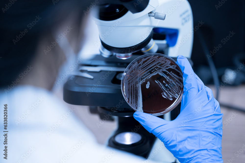 Scientist holding agar plate for diagnosis bacterial or
