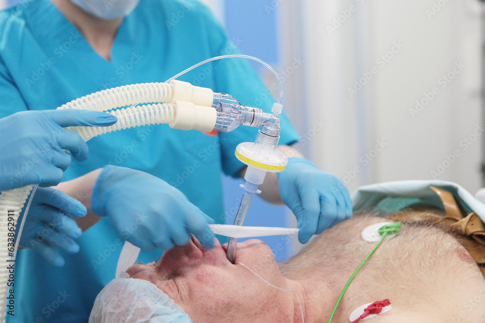 Tracheal intubation. Introduction of endotracheal tube. An elderly man