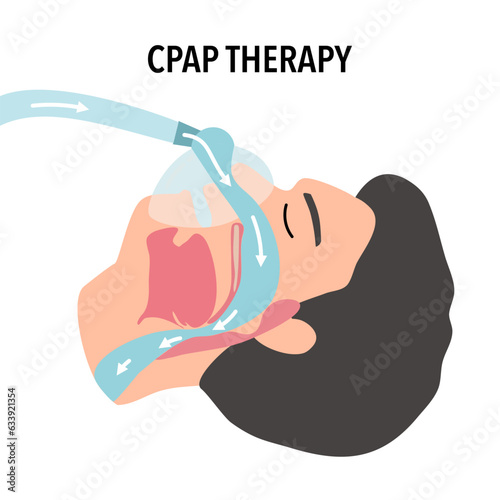 The man use Cpap therapy because he is sleep apnea. He cannot full sleep in the night.