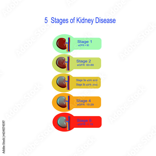 Infographic stages of chronic kidney disease