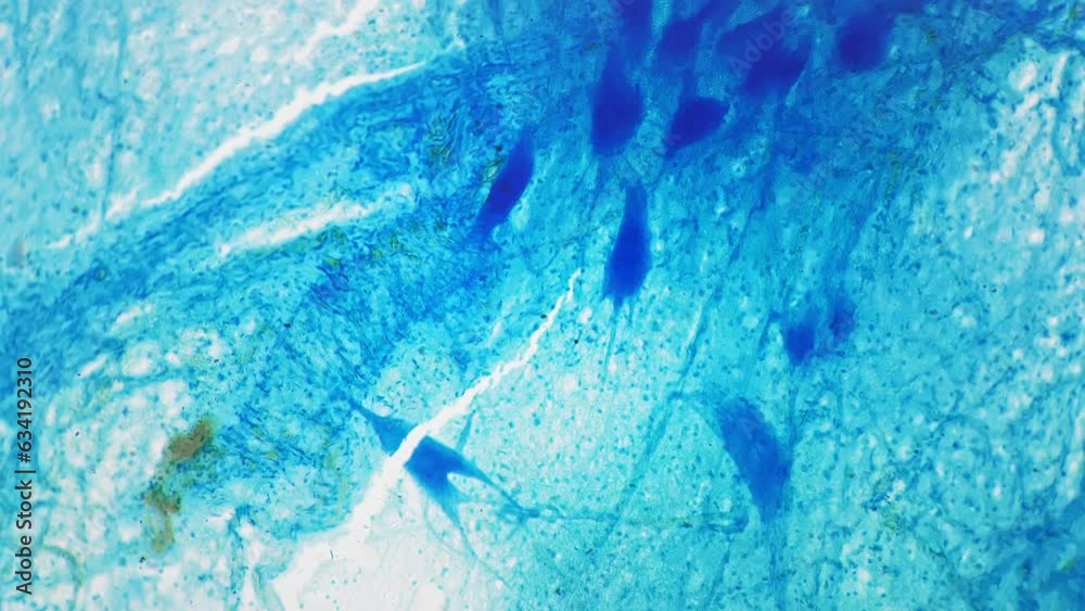 Motor neuron whole mount under microscope with 100 times magnification on bright field background. Generating and transferring impulses in people organism. Anatomy research on biology lesson theme