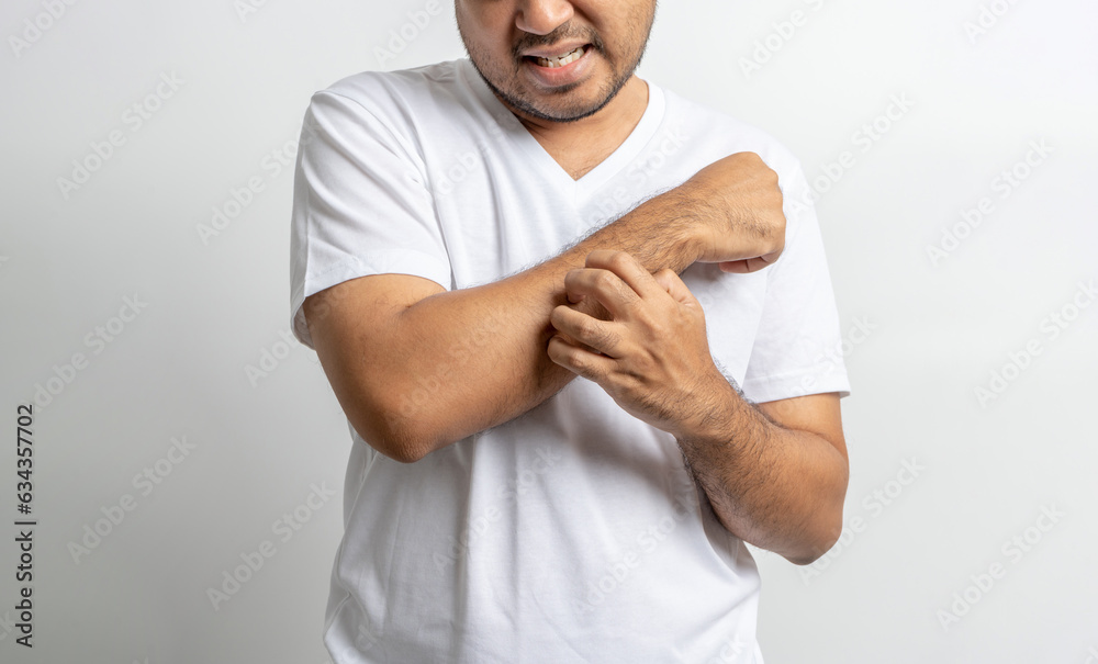 Man has a skin disease problems. He has an itch. He scratched his skin infection. Wearing white shirt standing on isolate