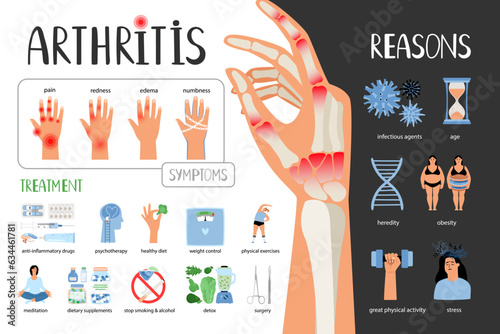 Rheumatoid arthritis vector medical poster. Symptoms treatment reasons of the disease. Medical infographic set with icons and other elements