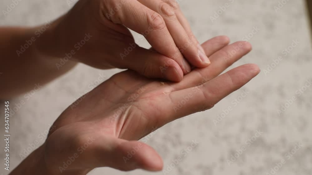 Close-up cropped shot of unrecognizable young man scratching and tearing off callus on palm of hand. Nervous male stresses out and rips some of skin off arm. Concept of bad habits, slow motion. Close-up cropped shot of unrecognizable young man scratching and tearing off callus on palm of hand. Nervous male stresses out and rips some of skin off arm. Concept of bad habits, slow motion.