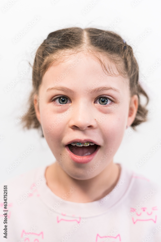 Little girl with rainbow braces Little girl with rainbow braces