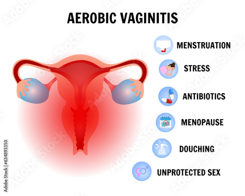 Aerobic vaginitis medical gynecology infographic causes