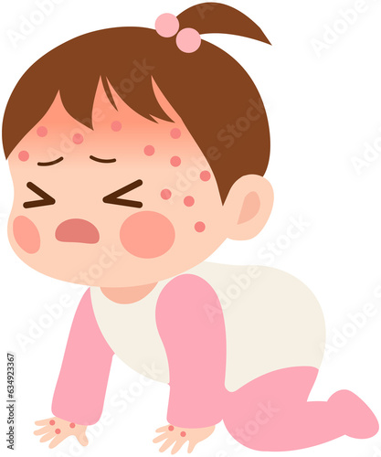 Baby Girl with Rash Fever icon 