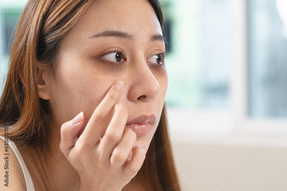 lack of sleep problem, Worried Asian young woman pointing finger at dark circles under her eyes lack of sleep problem, Worried Asian young woman pointing finger at dark circles under her eyes