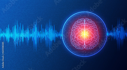 Neuromodulation and Neurostimulation - Conceptual Illustration