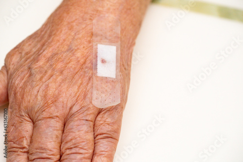 Close up old woman hand, upper limb or arm to the wounded waiting for nurse treatment on wound dressing a bloody and brine of patient on white background.