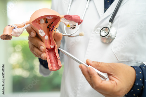 Uterus, doctor holding anatomy model for study diagnosis and treatment in hospital. photo