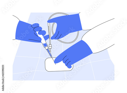 Endovascular surgery abstract concept vector illustration.