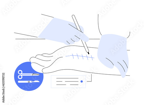 Hand surgery abstract concept vector illustration.